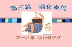 消化性溃疡ppt,病因、症状与治疗概述